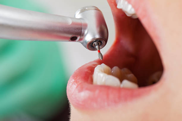 Best Emergency Dental Filling Replacement  in Belvedere, SC